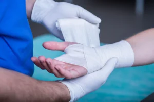 Workers’ Compensation For Burn Injuries