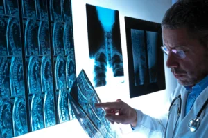 How Workers’ Compensation Treats Back Injuries