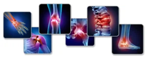 Types of Injuries Commonly Seen in Personal Injury Cases