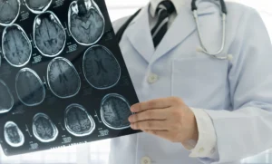 Understanding Traumatic Brain Injuries