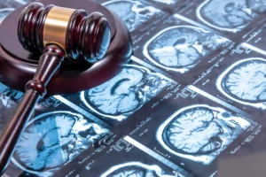 Ocala Brain Injury Lawyer
