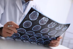 Brain Injury Care in Orlando